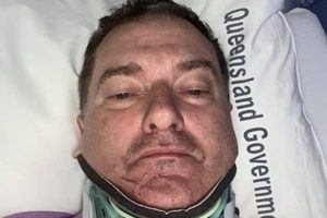 MP Hurt In Bike Crash